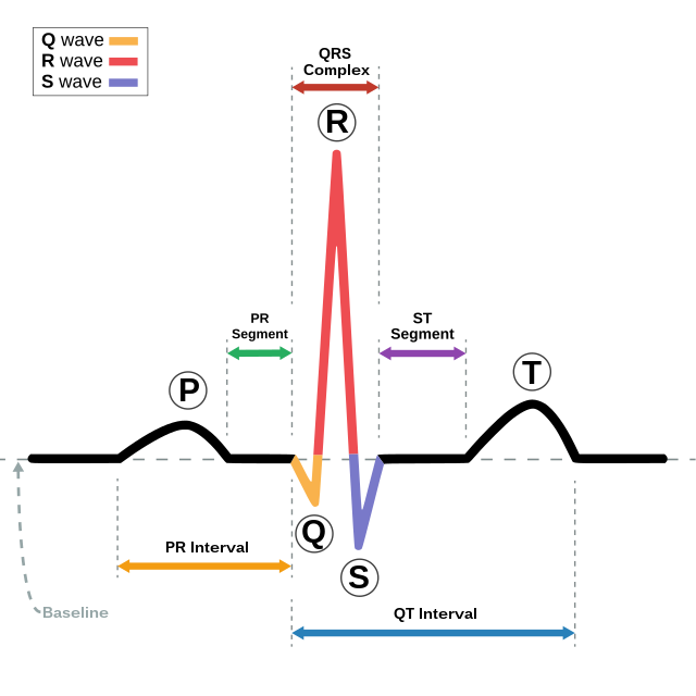 ECG